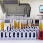 Investigacion de antígenos