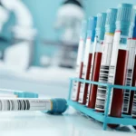 Proteina Cationica eosinofilica